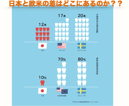 日本と欧米の差